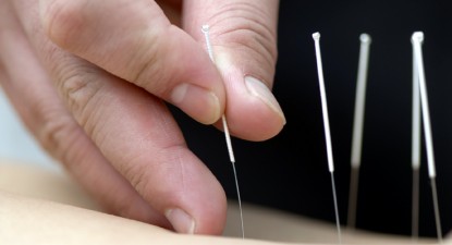 Varice vindecate cu acupunctură - teoexpres.ro
