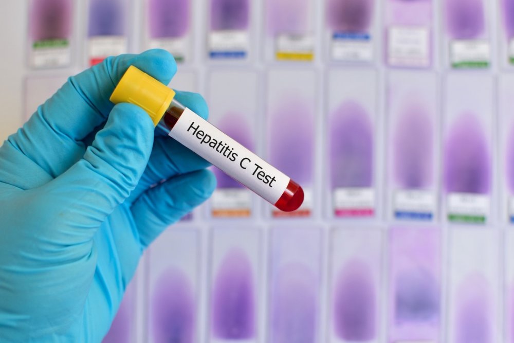 Campanie de testare gratuită pentru hepatita C - campanie-1620999884.jpg